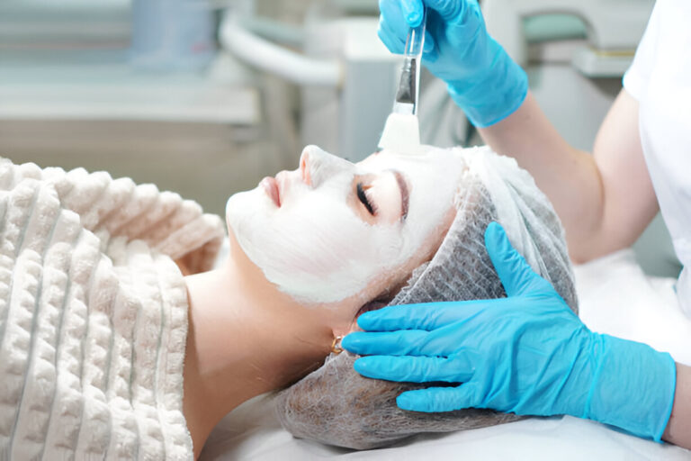 Benefits of Chemical Peels