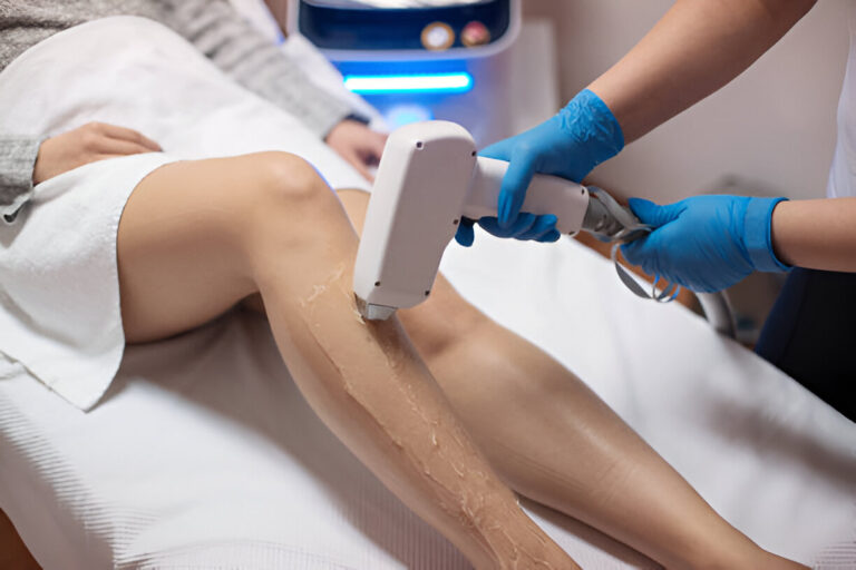 Laser Hair Removal
